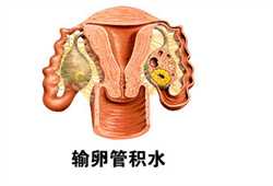 南京靠谱供卵中介，高龄女性生二胎能否做试管婴儿？专家解读提升二胎试管的