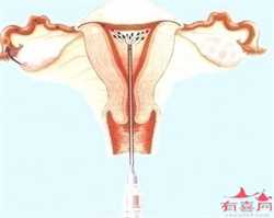 南京供卵生子的风险，泰国BNH医院简介，做三代试管婴儿怎么样?